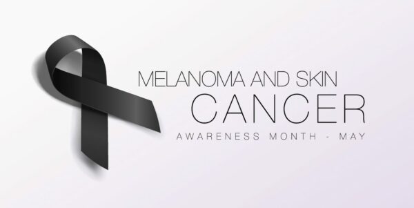 Melanoma Monday© and radiation therapy for skin cancer - Minneapolis ...